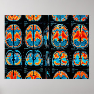 MRI hjärnskanning Poster
