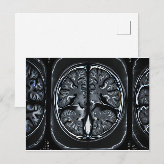 MRI hjärnskanning Vykort (Fram/baksida)