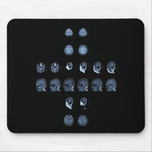 MRI-kor Musmatta