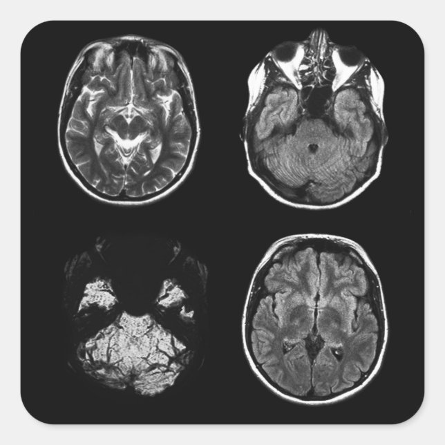 MRT-avsökning av hjärnan Fyrkantigt Klistermärke (Framsida)