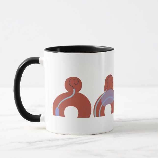 Mug de Aneurismas Mugg (Vänster)
