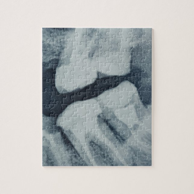 Nära på en dentalröntgen pussel (Vertikal)