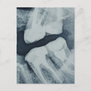Nära på en dentalröntgen vykort