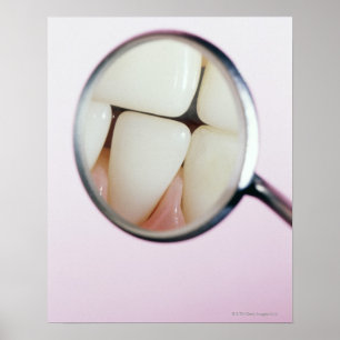 Närbild av tänder reflekterade i tand- spegel poster