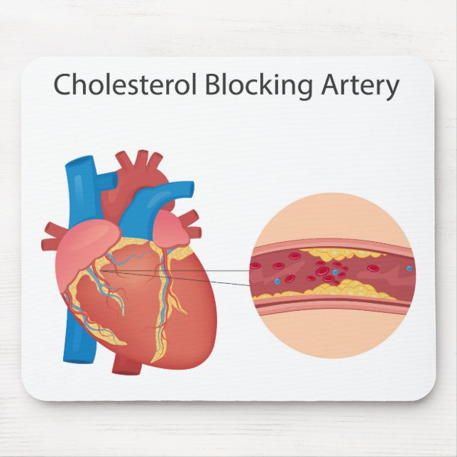 Narrogena blodkärl musmatta (Framsidan)