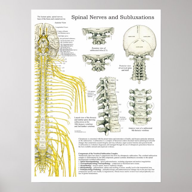 Nässelfeber och subluxationer Chiropraktik Poster (Framsidan)