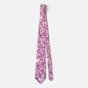 Necktie som visar retinaltumör slips