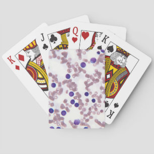 Neoplastisk lymphocytceller kortlek