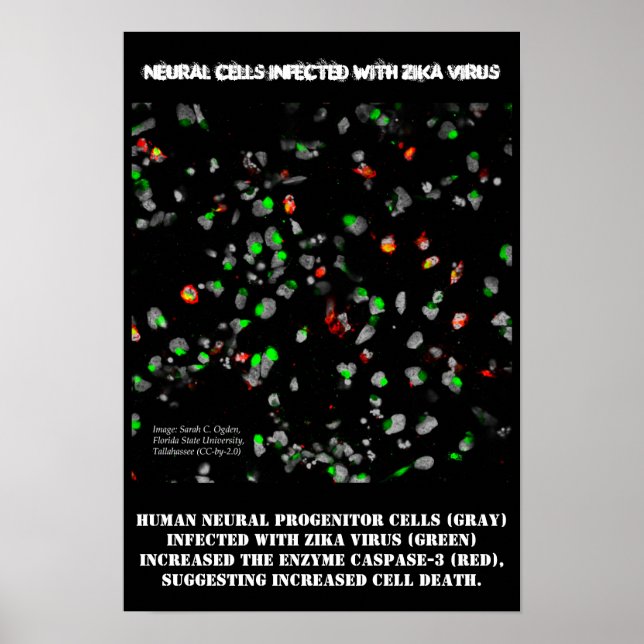 Neurala celler infekterade med Zika Poster med Ros (Framsidan)