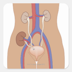 Njurtransplantation Fyrkantigt Klistermärke