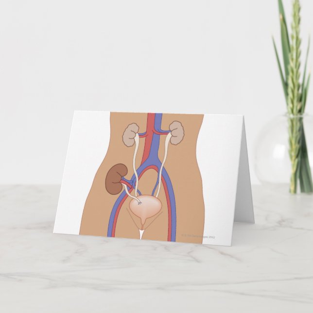 Njurtransplantation Kort (Framsida)