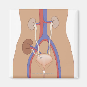 Njurtransplantation Magnet