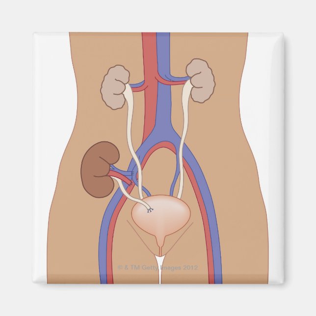 Njurtransplantation Magnet (Framsidan)