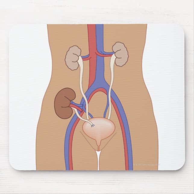 Njurtransplantation Musmatta (Framsidan)