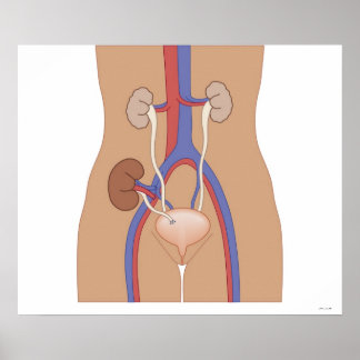 Njurtransplantation Poster