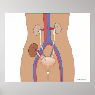 Njurtransplantation Poster