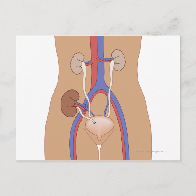 Njurtransplantation Vykort (Framsida)