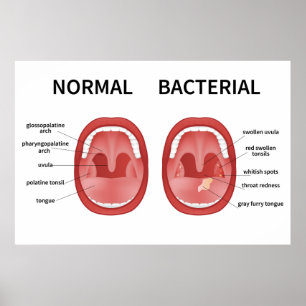 Normal bakteriell poster