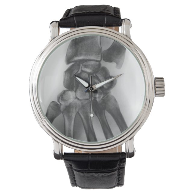 Normal handledning, röntgenstråle armbandsur (Framsida)