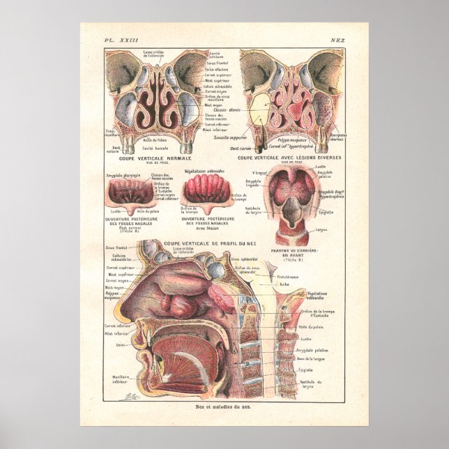 Nose & Sinusanatomi Poster i Fransk (Framsidan)