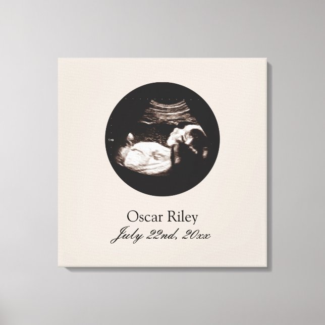 Nursery Art Baby Sonogram Ultrasound Photo Canvastryck (Framsida)