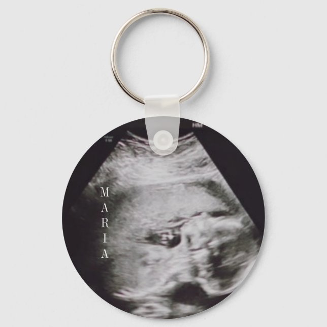 Nyckelkedja för ultraljud baby nyckelring (Framsida)