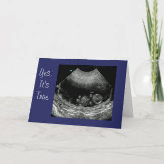 Nyfödd bebis Anouncement Meddelande