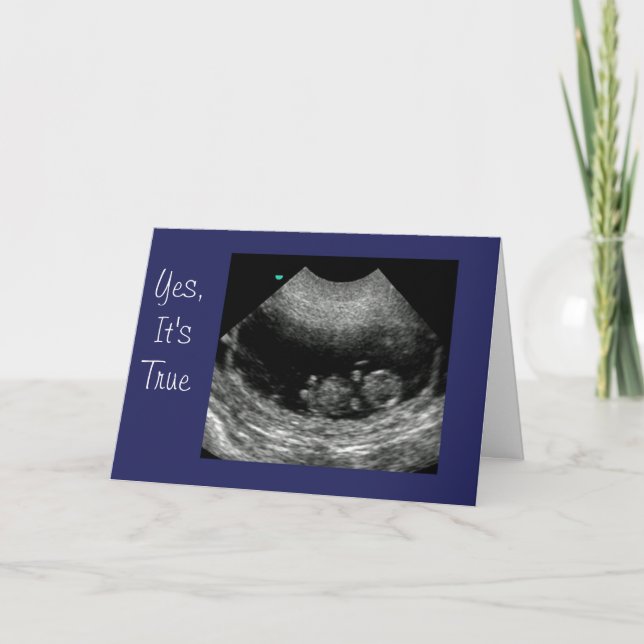 Nyfödd bebis Anouncement Meddelande (Framsida)