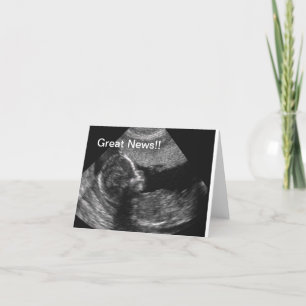 Nyfödd bebisUltrasound Meddelande