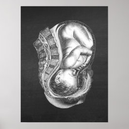 OBGYN Anatomy Art Decor no. 3 Poster