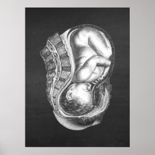 OBGYN Anatomy Art Decor no. 3 Poster