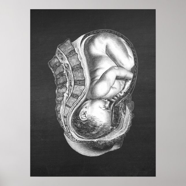 OBGYN Anatomy Art Decor no. 3 Poster (Framsidan)