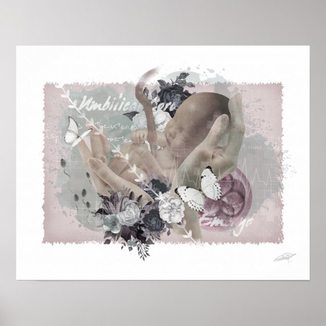 Obgyn Poster (Framsidan)