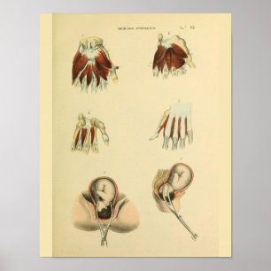 Obstetrics Anatomy Medical Art Print Poster