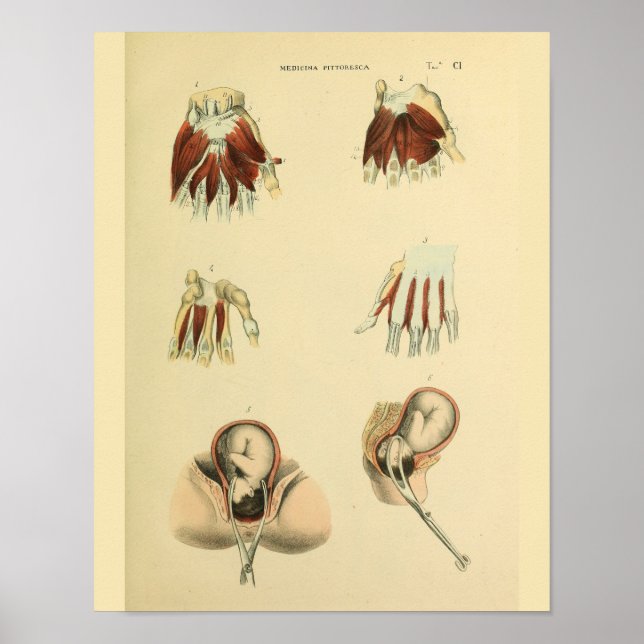 Obstetrics Anatomy Medical Art Print Poster (Framsidan)