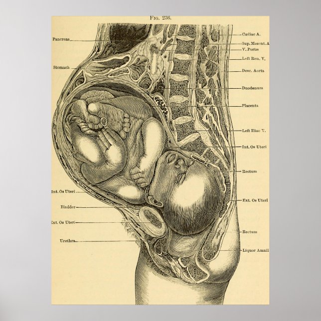 Obstetrics Illustration Poster (Framsidan)