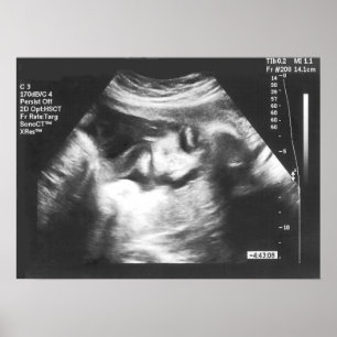 Ofoget fejkar Ultrasoundbilden Poster