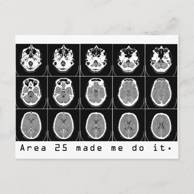 Område 25 fick mig att göra det. vykort (Framsida)