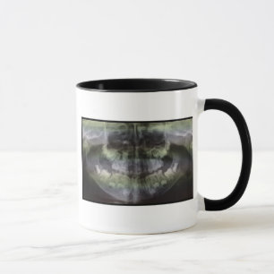 OPG-kaffemugg Mugg