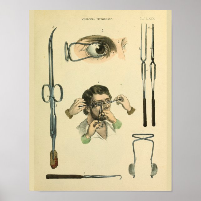 Optometry Öga Surgery Medical Art Print Poster (Framsidan)