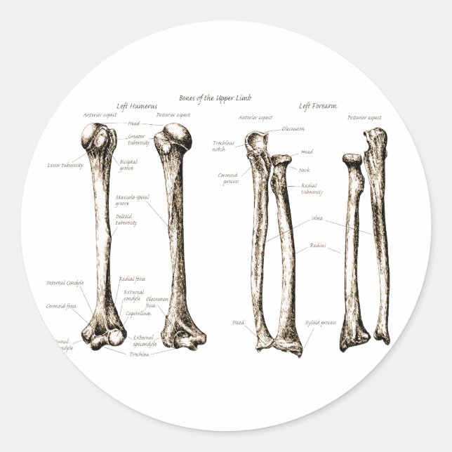 Övre Limb Sepia Runt Klistermärke (Framsida)