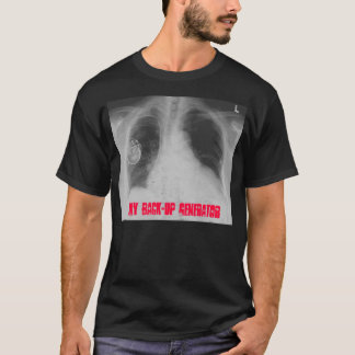 Pacemaker 2, min säkerhetskopiagenerator tee
