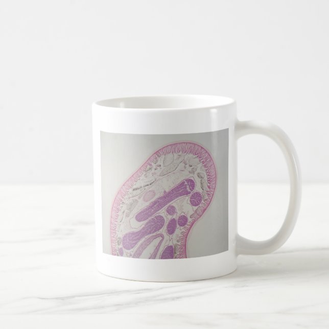 Parasitic nematodemask (Ascarissp.) Kaffemugg (Höger)