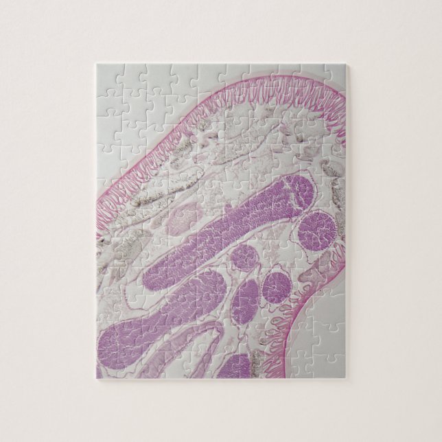 Parasitic nematodemask (Ascarissp.) Pussel (Vertikal)