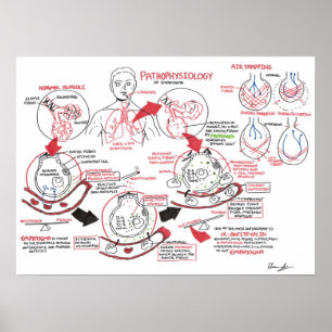 Pathophysiology av emphysemaen poster