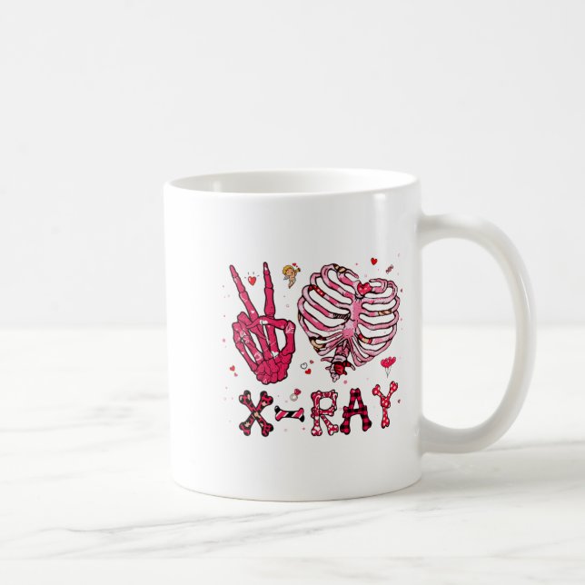 Peace Love X Ray Valentine  Kaffemugg (Höger)