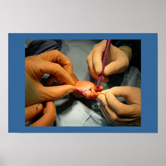 Pediatrisk handkirurgi poster (Framsidan)