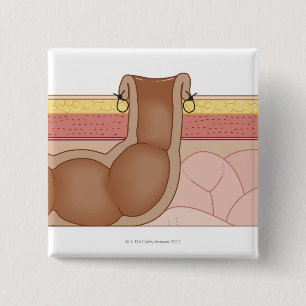 Permanent Colostomy Knapp
