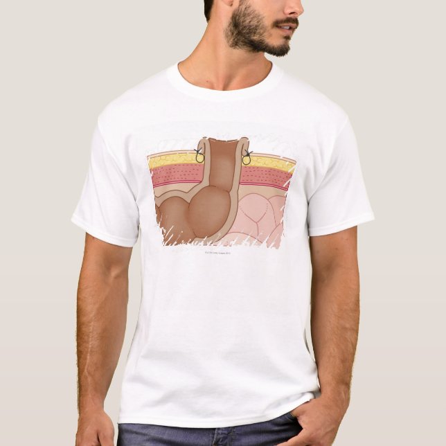 Permanent Colostomy T-shirt (Framsida)