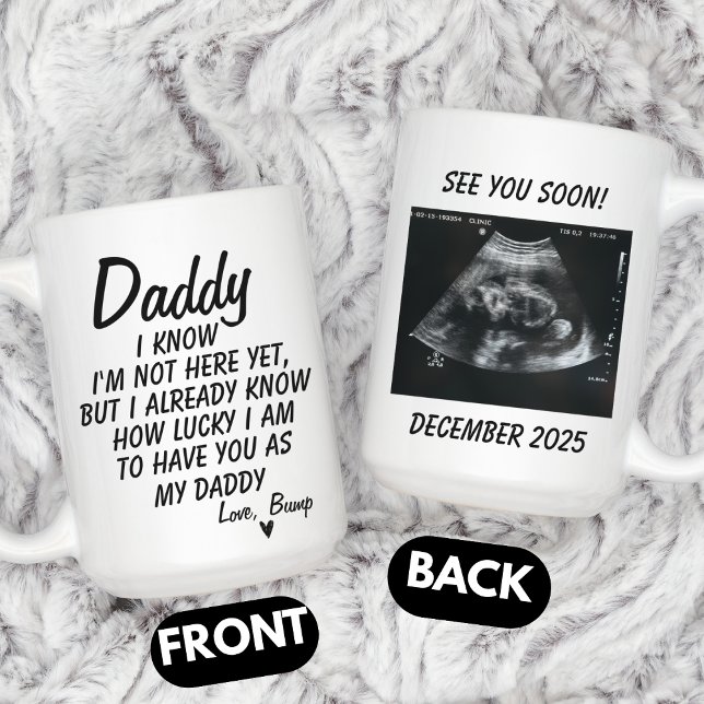 Personalized Sonogram Photo, Ultrasound Photo Baby Kaffemugg (Skapare uppladdad)